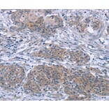 Immunohistochemistry - PDLIM2 Antibody from Signalway Antibody (36687) - Antibodies.com