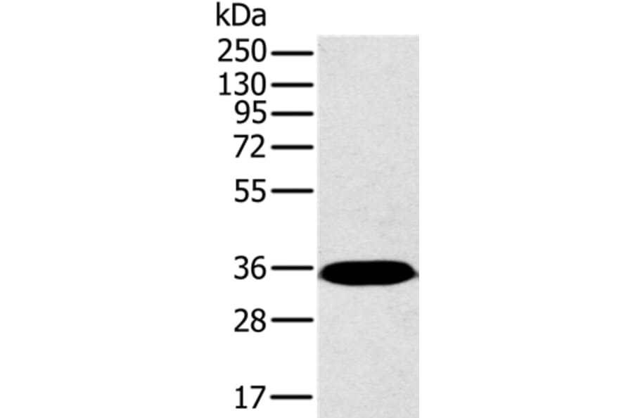 PPP2CA Antibody from Signalway Antibody (36699) - Antibodies.com