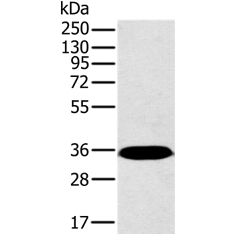 PPP2CA Antibody from Signalway Antibody (36699) - Antibodies.com