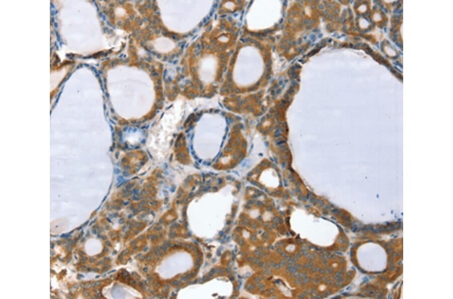Immunohistochemistry - PPP2CA Antibody from Signalway Antibody (36699) - Antibodies.com