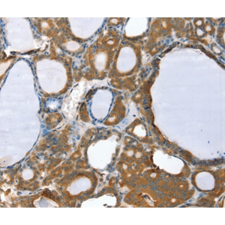 Immunohistochemistry - PPP2CA Antibody from Signalway Antibody (36699) - Antibodies.com