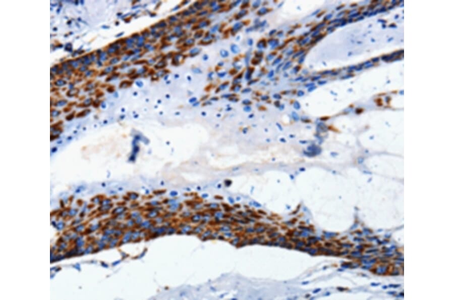 Immunohistochemistry - MT-CO2 Antibody from Signalway Antibody (36717) - Antibodies.com