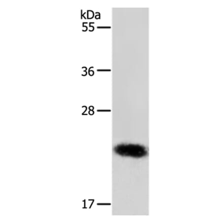 RAB22A Antibody from Signalway Antibody (36733) - Antibodies.com