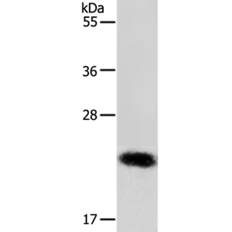 RAB22A Antibody from Signalway Antibody (36733) - Antibodies.com