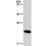 RAB22A Antibody from Signalway Antibody (36733) - Antibodies.com