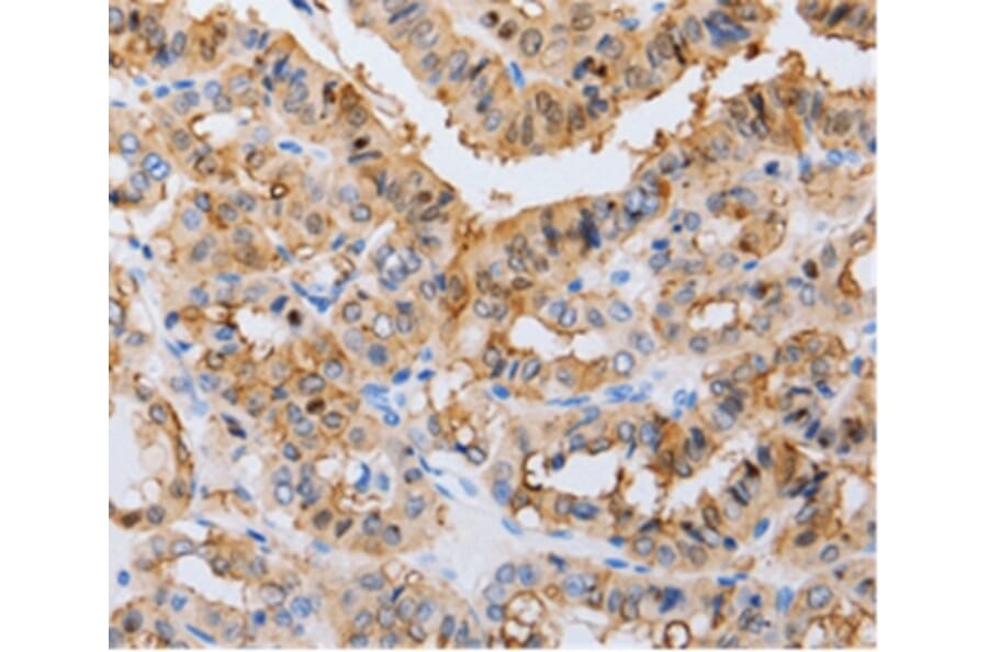 Immunohistochemistry - RAB22A Antibody from Signalway Antibody (36733) - Antibodies.com