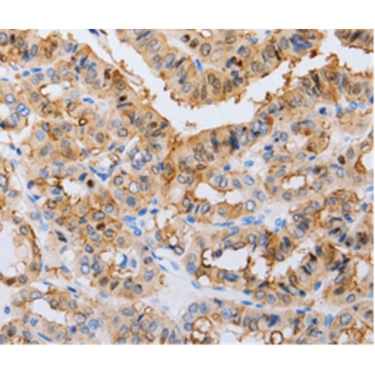 Immunohistochemistry - RAB22A Antibody from Signalway Antibody (36733) - Antibodies.com