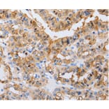 Immunohistochemistry - RAB22A Antibody from Signalway Antibody (36733) - Antibodies.com