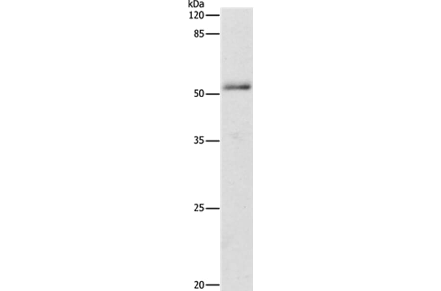 ADRA1B Antibody from Signalway Antibody (36762) - Antibodies.com