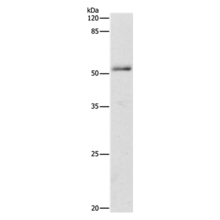 ADRA1B Antibody from Signalway Antibody (36762) - Antibodies.com