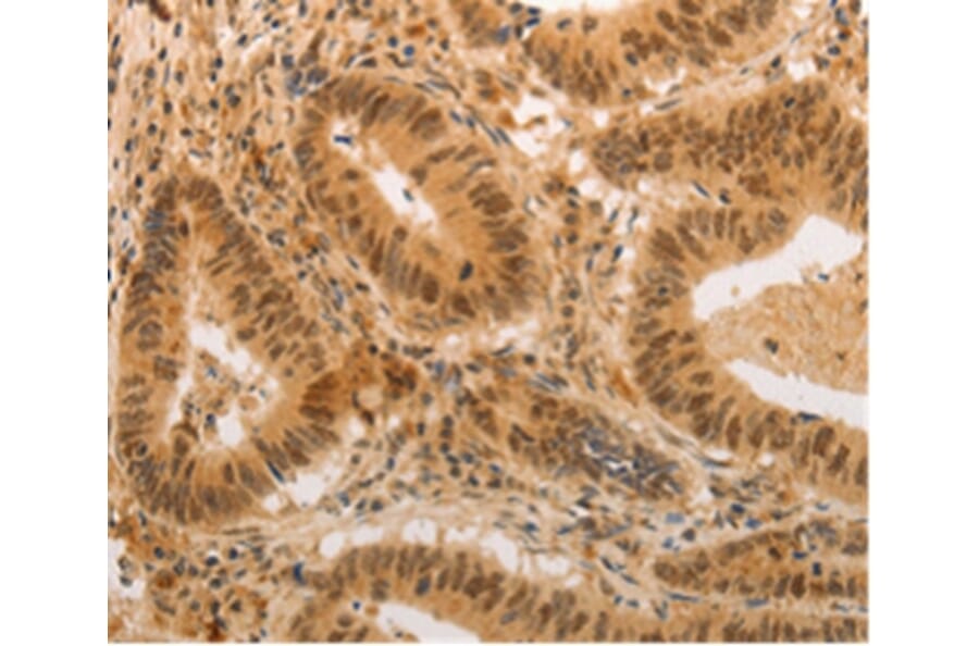 Immunohistochemistry - ADRA1B Antibody from Signalway Antibody (36762) - Antibodies.com