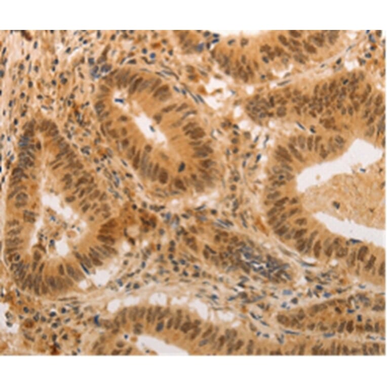 Immunohistochemistry - ADRA1B Antibody from Signalway Antibody (36762) - Antibodies.com