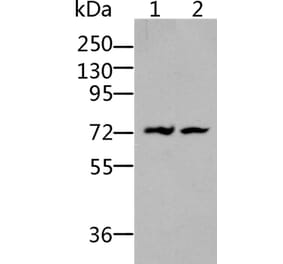 BDKRB2 Antibody from Signalway Antibody (36766) - Antibodies.com