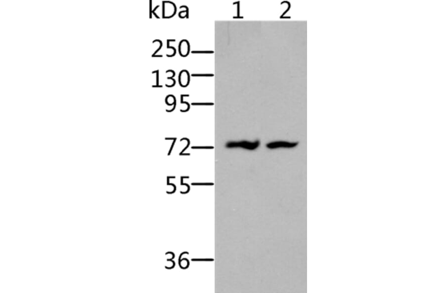 BDKRB2 Antibody from Signalway Antibody (36766) - Antibodies.com
