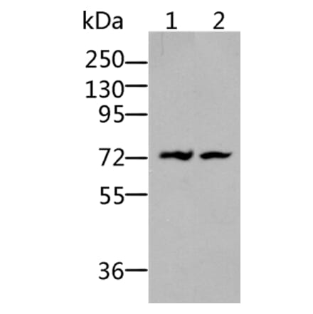 BDKRB2 Antibody from Signalway Antibody (36766) - Antibodies.com