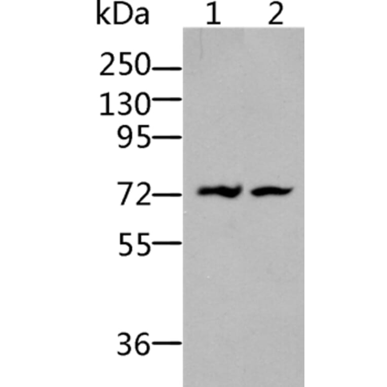 BDKRB2 Antibody from Signalway Antibody (36766) - Antibodies.com