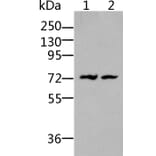 BDKRB2 Antibody from Signalway Antibody (36766) - Antibodies.com