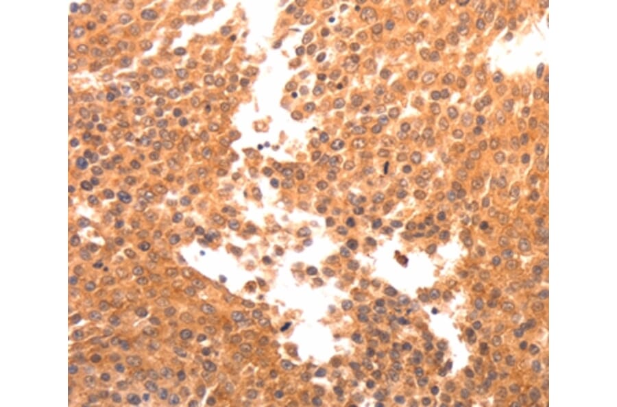 Immunohistochemistry - BDKRB2 Antibody from Signalway Antibody (36766) - Antibodies.com