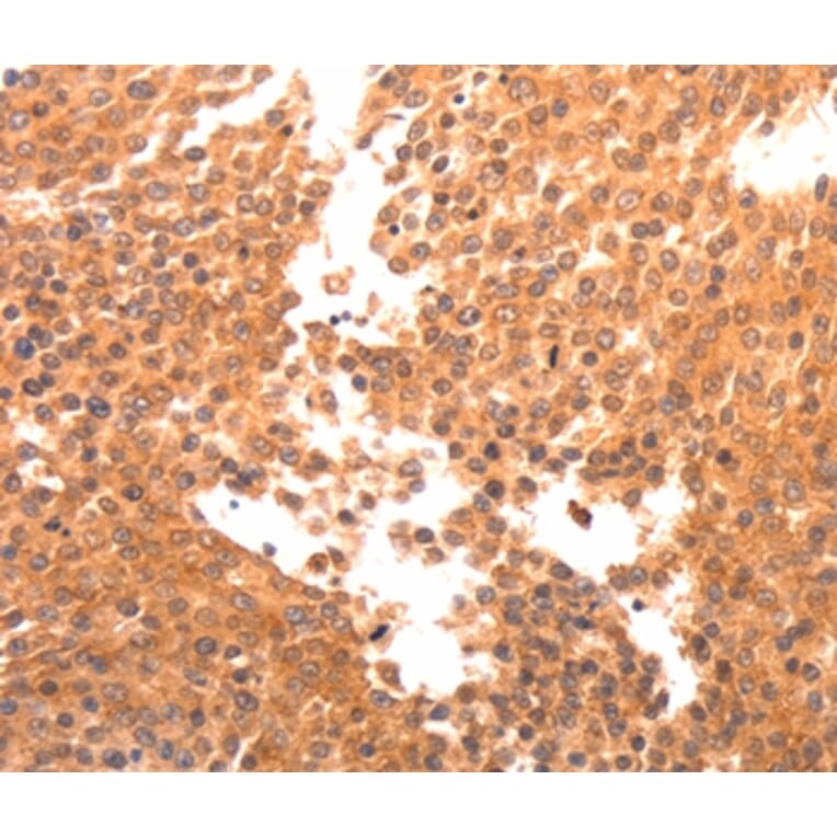 Immunohistochemistry - BDKRB2 Antibody from Signalway Antibody (36766) - Antibodies.com