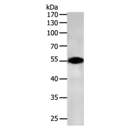 CASP12 Antibody from Signalway Antibody (36777) - Antibodies.com
