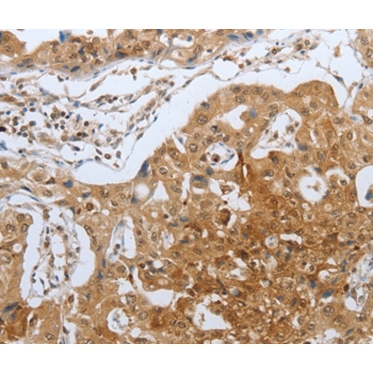 Immunohistochemistry - CASP12 Antibody from Signalway Antibody (36777) - Antibodies.com