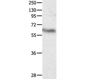 DPYSL4 Antibody from Signalway Antibody (36805) - Antibodies.com