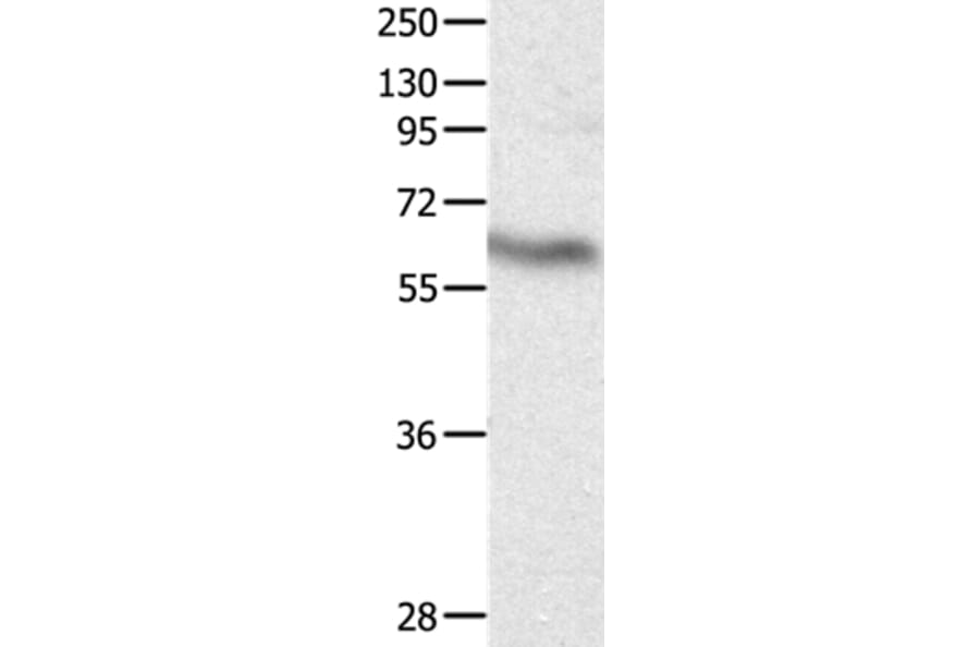 DPYSL4 Antibody from Signalway Antibody (36805) - Antibodies.com