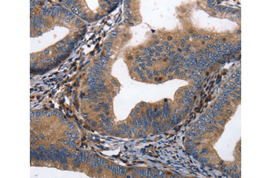 Immunohistochemistry - DPYSL4 Antibody from Signalway Antibody (36805) - Antibodies.com