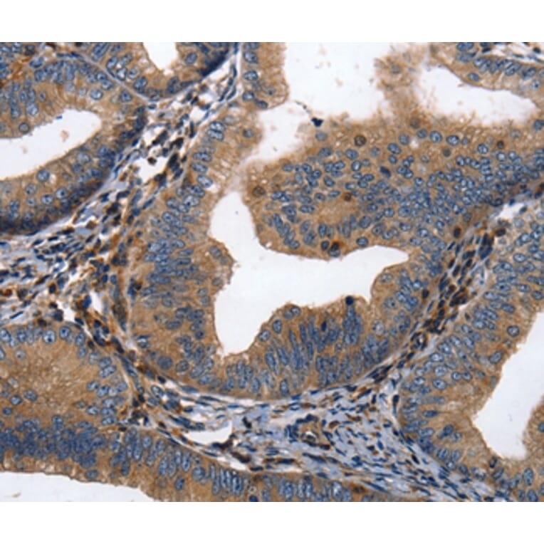 Immunohistochemistry - DPYSL4 Antibody from Signalway Antibody (36805) - Antibodies.com