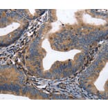 Immunohistochemistry - DPYSL4 Antibody from Signalway Antibody (36805) - Antibodies.com