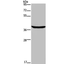 FOXE1 Antibody from Signalway Antibody (36866) - Antibodies.com