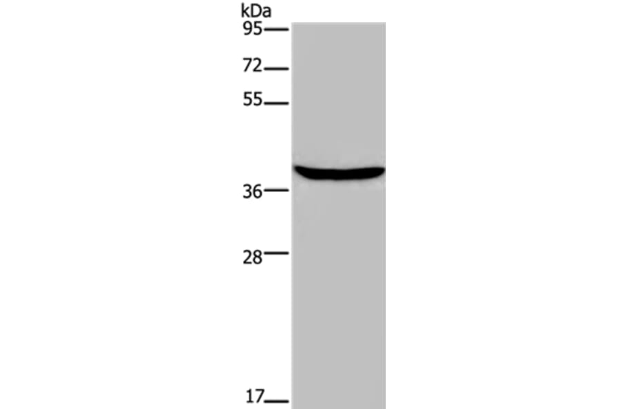 FOXE1 Antibody from Signalway Antibody (36866) - Antibodies.com