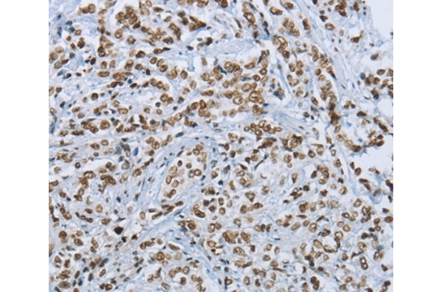 Immunohistochemistry - FOXE1 Antibody from Signalway Antibody (36866) - Antibodies.com