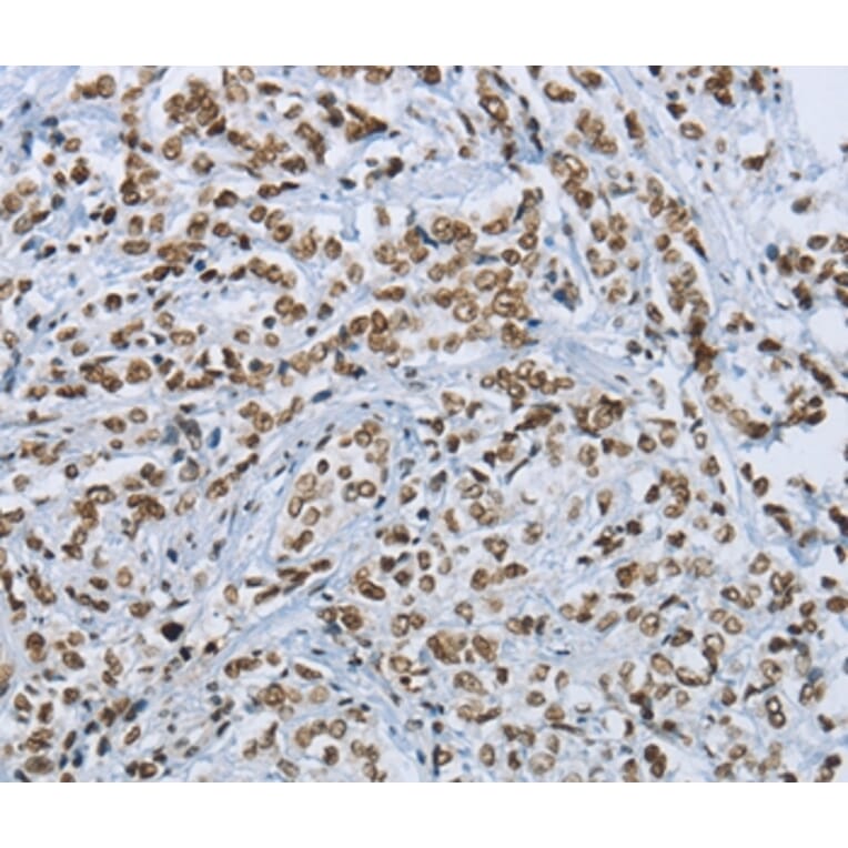 Immunohistochemistry - FOXE1 Antibody from Signalway Antibody (36866) - Antibodies.com