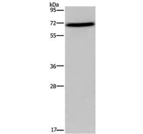 FOXO1 Antibody from Signalway Antibody (36870) - Antibodies.com