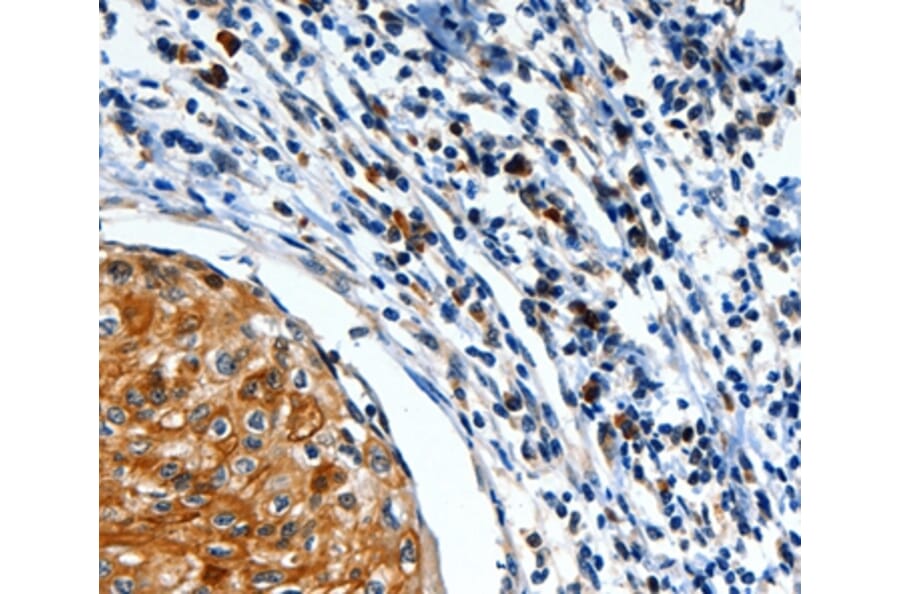 Immunohistochemistry - FOXO1 Antibody from Signalway Antibody (36870) - Antibodies.com