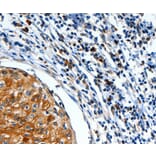 Immunohistochemistry - FOXO1 Antibody from Signalway Antibody (36870) - Antibodies.com