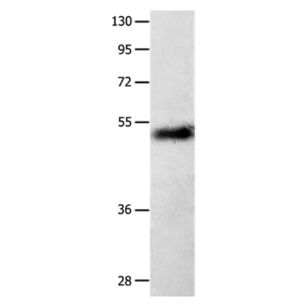 SLC2A1 Antibody from Signalway Antibody (36901) - Antibodies.com
