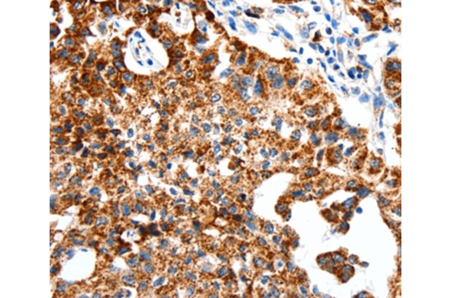 Immunohistochemistry - SLC2A1 Antibody from Signalway Antibody (36901) - Antibodies.com