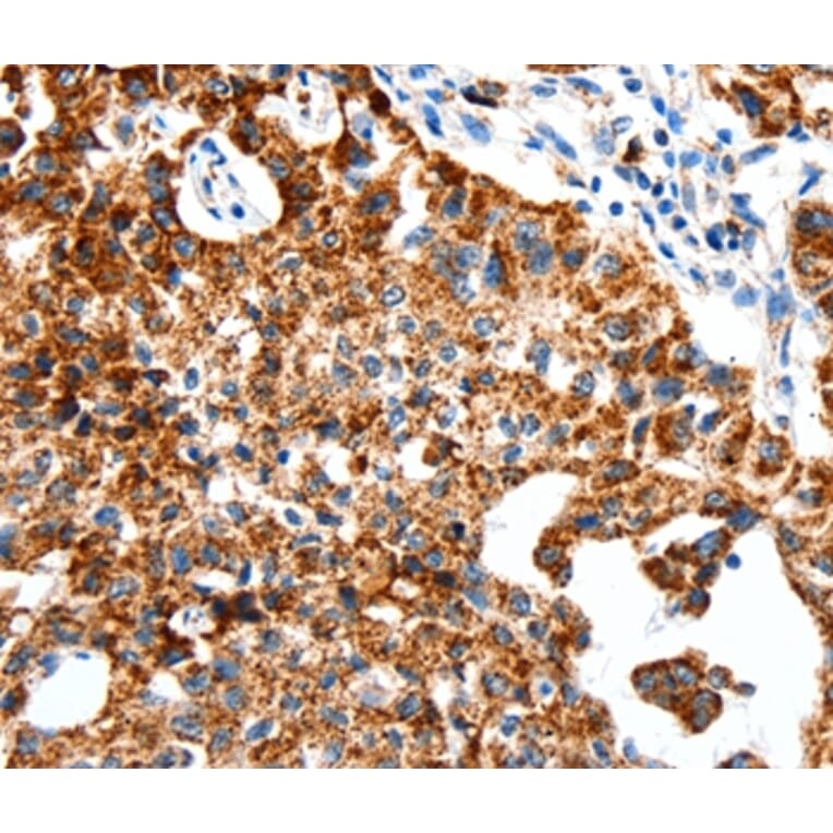 Immunohistochemistry - SLC2A1 Antibody from Signalway Antibody (36901) - Antibodies.com