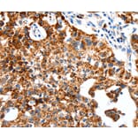 Immunohistochemistry - SLC2A1 Antibody from Signalway Antibody (36901) - Antibodies.com