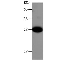 IGFBP1 Antibody from Signalway Antibody (36929) - Antibodies.com