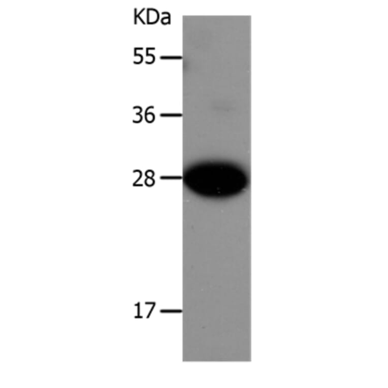 IGFBP1 Antibody from Signalway Antibody (36929) - Antibodies.com