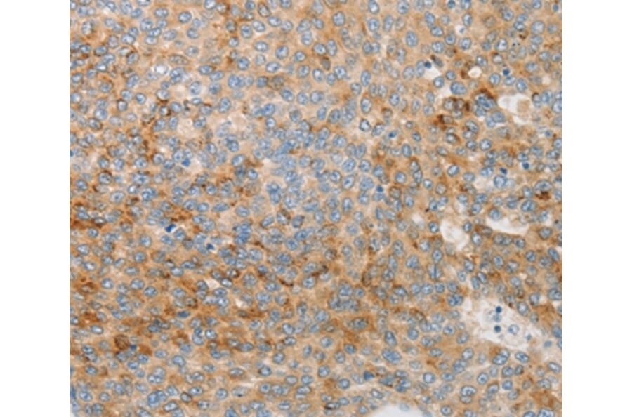 Immunohistochemistry - IGFBP1 Antibody from Signalway Antibody (36929) - Antibodies.com
