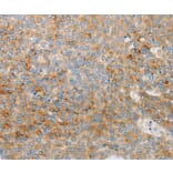 Immunohistochemistry - IGFBP1 Antibody from Signalway Antibody (36929) - Antibodies.com