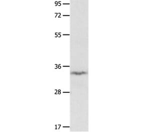 IGFBP7 Antibody from Signalway Antibody (36930) - Antibodies.com