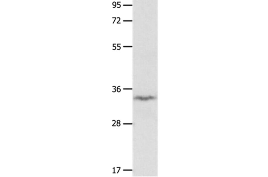 IGFBP7 Antibody from Signalway Antibody (36930) - Antibodies.com