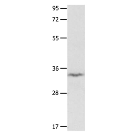 IGFBP7 Antibody from Signalway Antibody (36930) - Antibodies.com