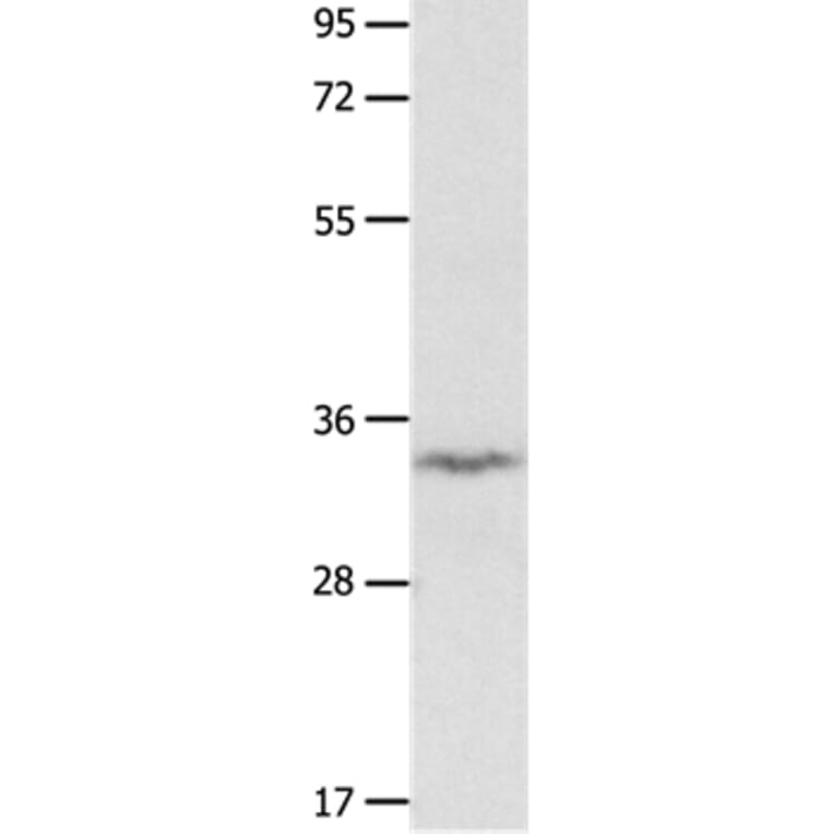IGFBP7 Antibody from Signalway Antibody (36930) - Antibodies.com