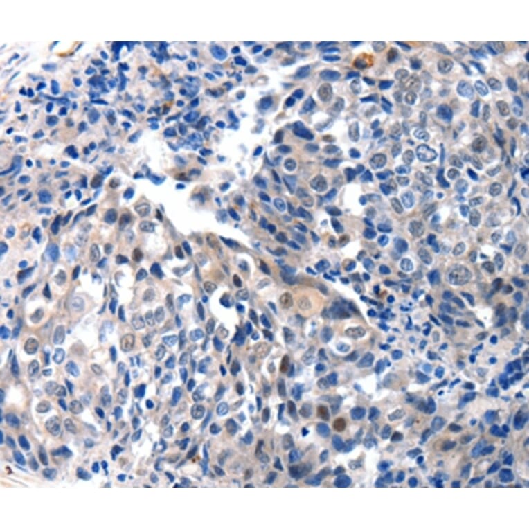 Immunohistochemistry - IGFBP7 Antibody from Signalway Antibody (36930) - Antibodies.com